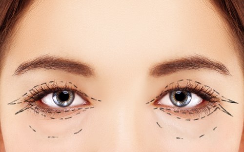 Best Blepharoplasty Surgery in Mumbai by Dr Debraj Shome at The Esthetic Clinics